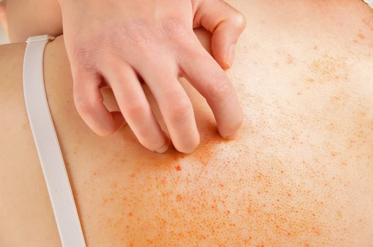 خلايا النحل