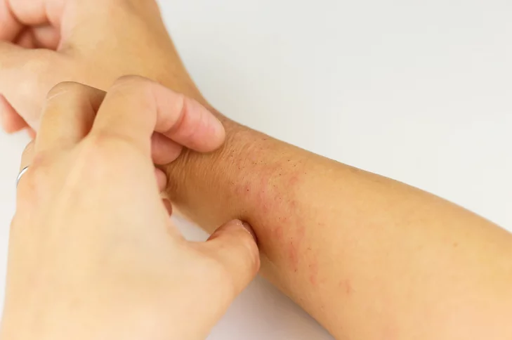 خلايا النحل