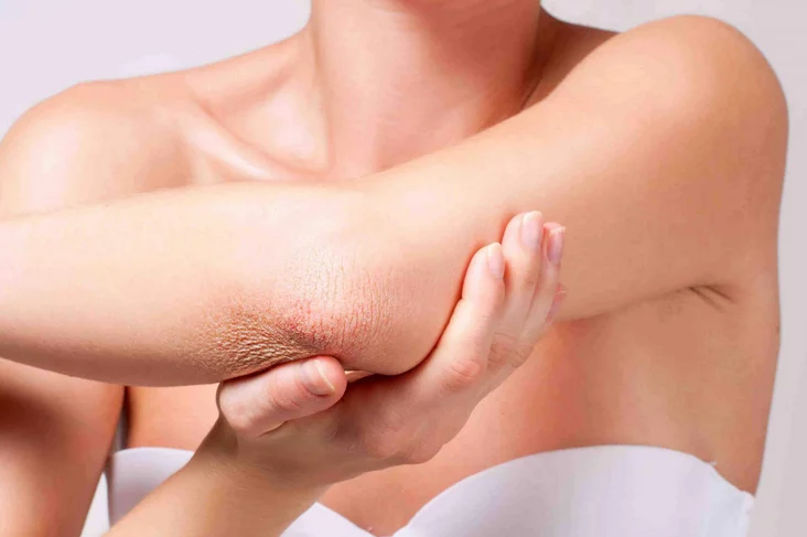 Capture 60 - موقع رموش