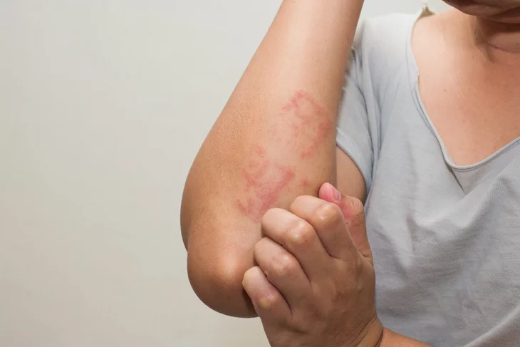 خلايا النحل