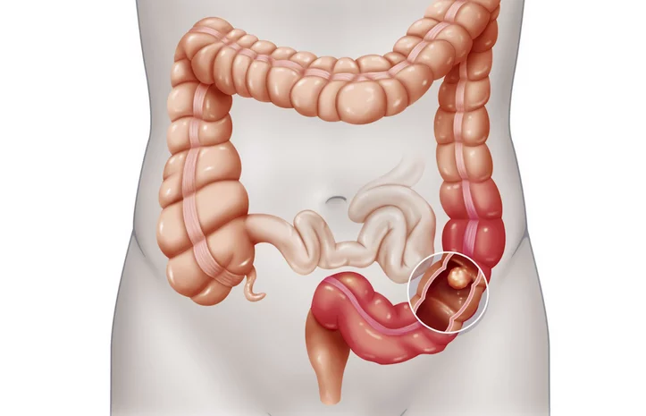 hn - موقع رموش
