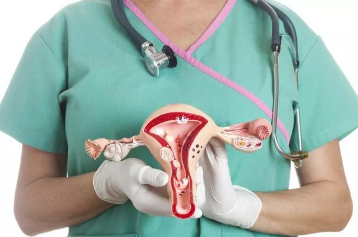 أكياس المبيض