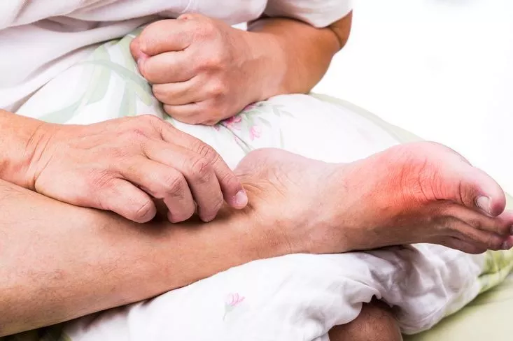 مرض البري بري ينتج عن نقص فيتامين فيه HJ 3 - موقع رموش