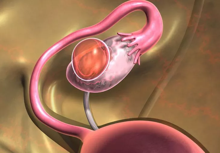 أكياس المبيض