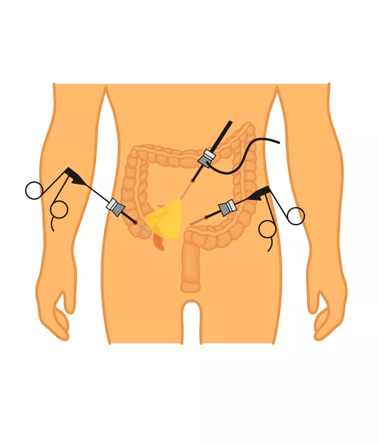 WhatsApp Image 2022 08 17 at 1.59.21 PM - موقع رموش