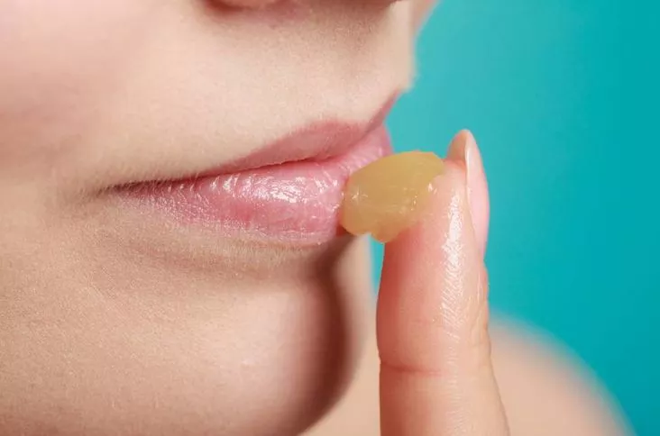 تشققات الشفاه