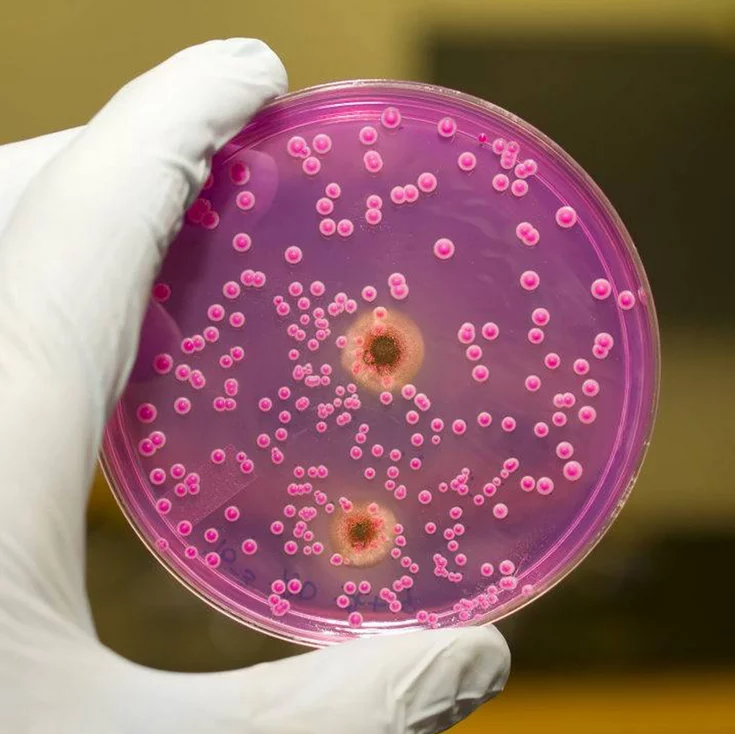 تعرف على أعراض التهاب المهبل الجرثومي gbfh - موقع رموش