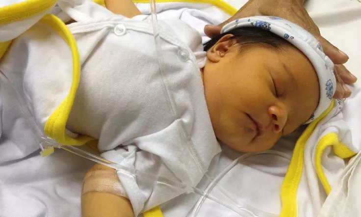 اسباب اليرقان عند الاطفال و تعتبر مرض اليرقان خطير اليرقان عند الاطفال