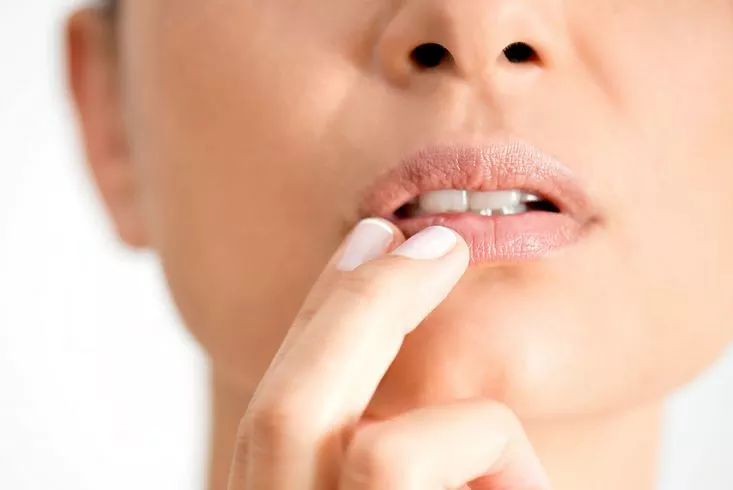 تشققات الشفاه