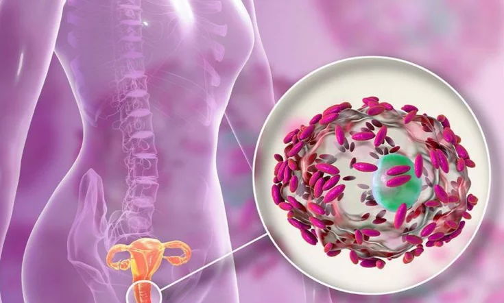 تعرف على أعراض التهاب المهبل الجرثومي jgf 1 - موقع رموش