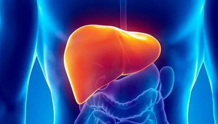 مرض الكبد الدهني