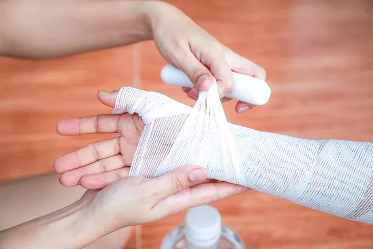 تعرف على طرق علاج الحروق علاج الحروق