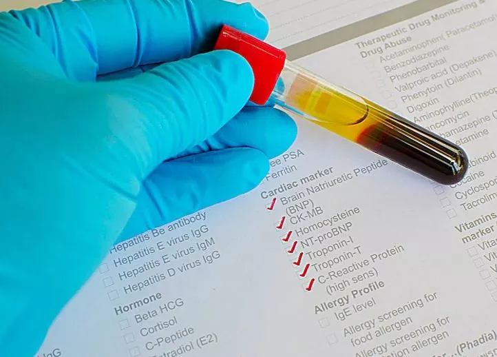 أمراض القلب