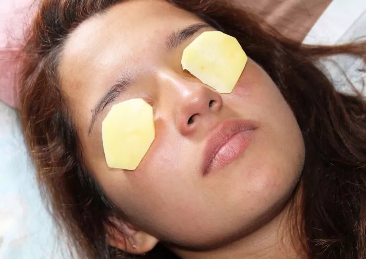 5 أقنعة منزلية لـ تفتيح البشرة تفتيح البشرة